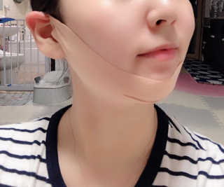 아이디플라코스메틱 아이디 페이스핏 마이너스 밴드 — 4점을 준 리뷰어가 2019년 9월 올린 사용 사진