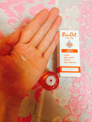 Bio-oil(바이오오일) 바이오오일(Bio-oil) — 3점을 준 리뷰어가 2017년 2월 올린 사용 사진