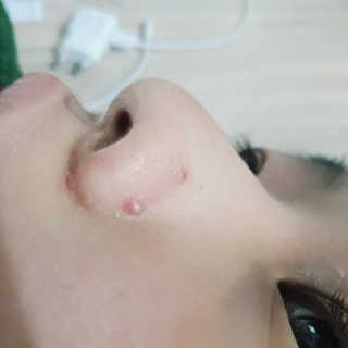 셀리맥스 노니 에너지 앰플 — 5점을 준 리뷰어가 2019년 8월 올린 사용 사진