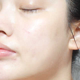 GoodDay Skincare GoodDay 강황 마스크 — 4점을 준 리뷰어가 2020년 2월 올린 사용 사진