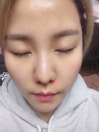 나이팅게일 데일리 더마 클렌징패드 마일드 — 4점을 준 리뷰어가 2018년 12월 올린 사용 사진