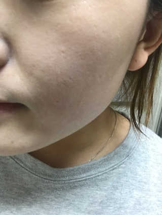 bin님이 올린 리뷰 사진 3