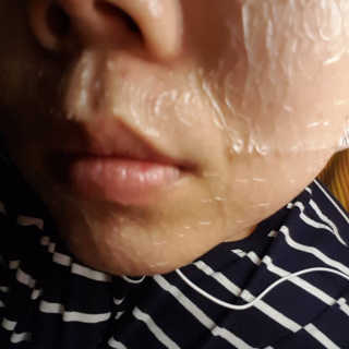 23years old 인쎄라 실프팅 쁘띠 마스크(5장) — 5점을 준 리뷰어가 2017년 7월 올린 사용 사진