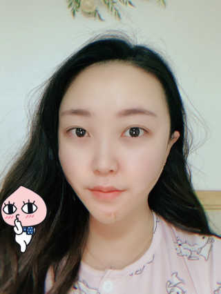 아이디플라코스메틱 아이디 페이스핏 마이너스 밴드 — 5점을 준 리뷰어가 2019년 11월 올린 사용 사진