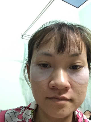 엘리자베카 덩키피기 덩키밀키 EGF 클링아이패치 — 5점을 준 리뷰어가 2019년 5월 올린 사용 사진