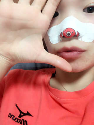 나이팅게일 TAKO PACK NOSE [문어코팩] — 5점을 준 리뷰어가 2016년 11월 올린 사용 사진
