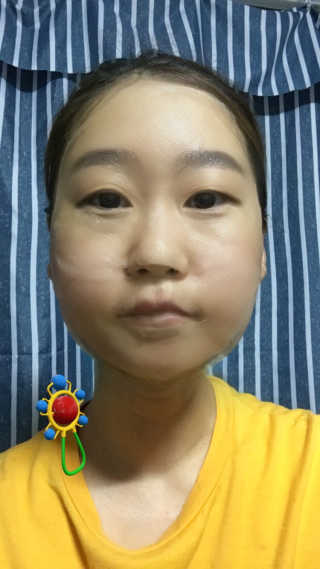 메디타임 멜라반 더마 토닝 씬젤 — 4점을 준 리뷰어가 2019년 6월 올린 사용 사진
