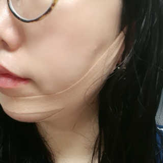 아이디플라코스메틱 아이디 페이스핏 마이너스 밴드 — 5점을 준 리뷰어가 2019년 9월 올린 사용 사진