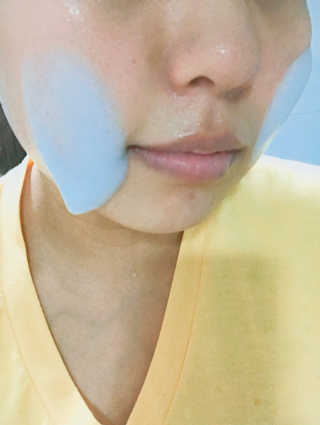 세바메드 클리어 페이스 안티박테리얼 클렌징 폼 — 3.67점을 준 리뷰어가 2017년 5월 올린 사용 사진