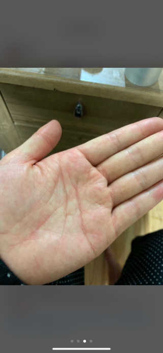 비알티씨 더 퍼스트 앰플 에센스 — 5점을 준 리뷰어가 2019년 4월 올린 사용 사진