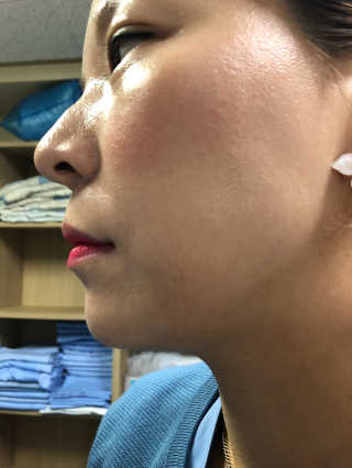 보호보호 롱라스팅 메이크업 픽서 미스트 — 5점을 준 리뷰어가 2019년 11월 올린 사용 사진