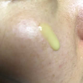 보타니티 [홍]조[진]정[결]케어 플라본 세럼 — 5점을 준 리뷰어가 2018년 5월 올린 사용 사진