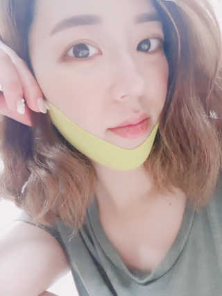 스케덤 시카 리프팅밴드 — 5점을 준 리뷰어가 2019년 5월 올린 사용 사진