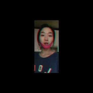 스케덤 펩타이드 리프팅밴드 — 2.5점을 준 리뷰어가 2019년 3월 올린 사용 사진