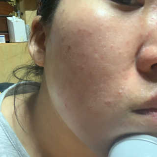 [더마퀸]쿨링스틱 페이스앤아이 — 4점을 준 리뷰어가 2019년 5월 올린 사용 사진