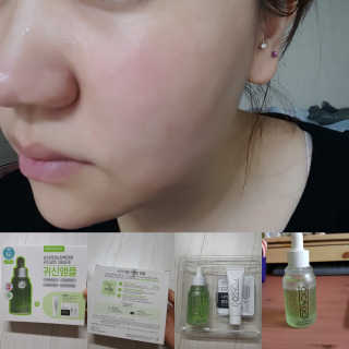 시카고 시카 더블 이펙트 앰플 30ml 기획세트 — 5점을 준 리뷰어가 2018년 8월 올린 사용 사진