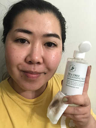 Emogurloveskincare님이 올린 리뷰 사진 4