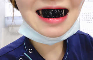 the naked object 디블랙팩치약 디블랙칫솔 세트 — 5점을 준 리뷰어가 2019년 1월 올린 사용 사진