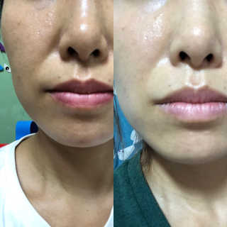라스맘님이 올린 리뷰 사진 4