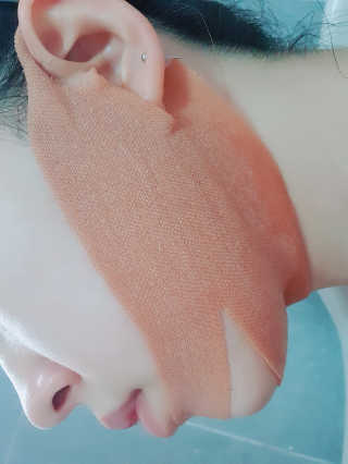 아이디플라코스메틱 아이디 페이스핏 마이너스 밴드 — 4점을 준 리뷰어가 2020년 3월 올린 사용 사진