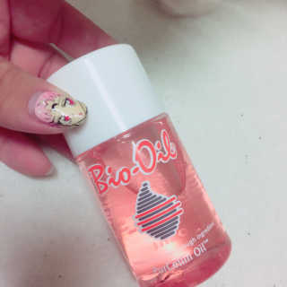 Bio-oil(바이오오일) 바이오오일 — 4.5점을 준 리뷰어가 2016년 10월 올린 사용 사진