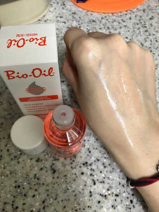 Bio-oil(바이오오일) 바이오오일(Bio-oil) — 5점을 준 리뷰어가 2017년 2월 올린 사용 사진