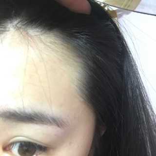 다슈코리아 다슈 데일리 헤어라인 커버 쿠션 — 4.5점을 준 리뷰어가 2017년 5월 올린 사용 사진