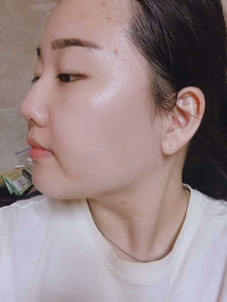 닥터펩티 제이앤코슈 펩타이드 볼륨 에센스 — 3.5점을 준 리뷰어가 2019년 4월 올린 사용 사진