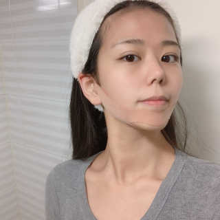 아이디플라코스메틱 아이디 페이스핏 마이너스 밴드 — 4점을 준 리뷰어가 2020년 1월 올린 사용 사진