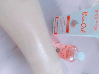 Bio-oil(바이오오일) 바이오오일 — 4.5점을 준 리뷰어가 2016년 10월 올린 사용 사진
