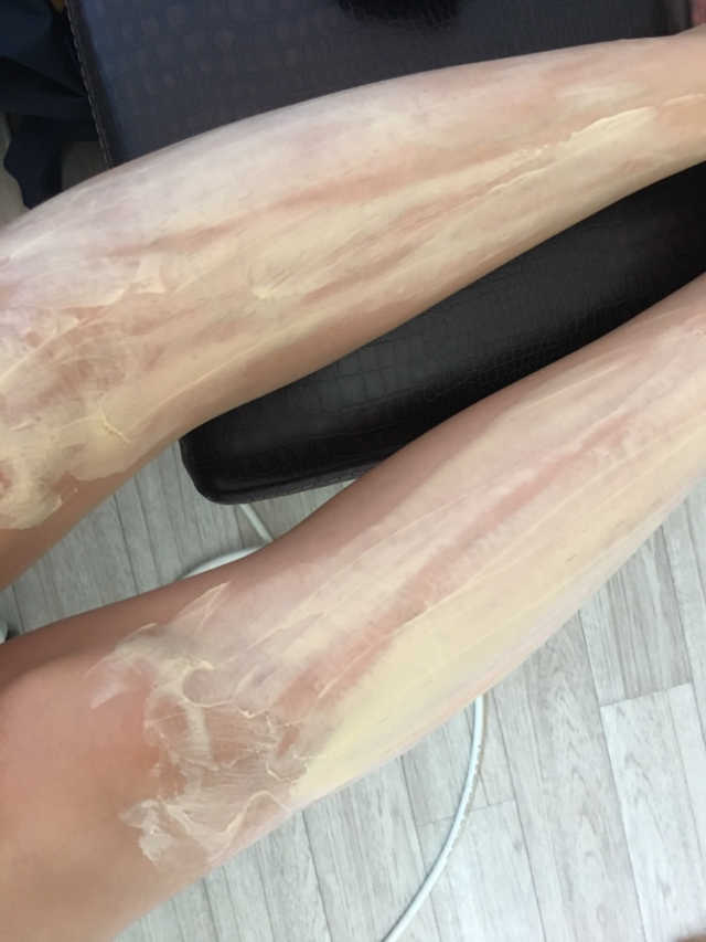 꿀곰 제모크림 리뷰 사진