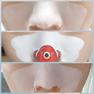 나이팅게일 TAKO PACK NOSE [문어코팩] — 3.67점을 준 리뷰어가 2018년 7월 올린 사용 사진