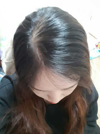 다슈코리아 다슈 데일리 헤어라인 커버 쿠션 — 3점을 준 리뷰어가 2017년 4월 올린 사용 사진