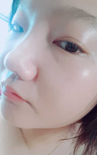 데이셀코스메틱 메디 랩 블랙로즈 블로썸 비비 50g — 4.5점을 준 리뷰어가 2017년 6월 올린 사용 사진
