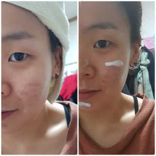 23years old 바데카실 오리지널 — 4점을 준 리뷰어가 2017년 10월 올린 사용 사진