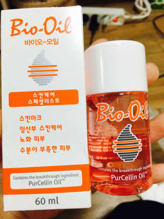 Bio-oil(바이오오일) 바이오오일 — 4점을 준 리뷰어가 2016년 9월 올린 사용 사진