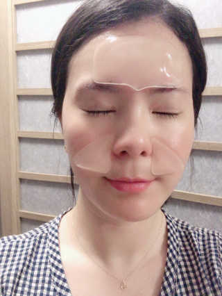 아이디플라코스메틱 아이디 페이스핏 플러스 패치 — 5점을 준 리뷰어가 2019년 10월 올린 사용 사진