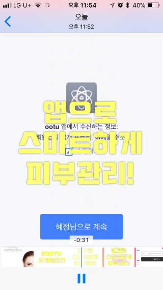 오오티유 45도 앵글 선코트 (with OOTU 앱) — 4.33점을 준 리뷰어가 2017년 11월 올린 사용 사진