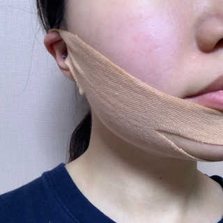 아이디플라코스메틱 아이디 페이스핏 마이너스 밴드 — 4점을 준 리뷰어가 2019년 9월 올린 사용 사진