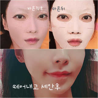 쏘내추럴 핑크 머드 마스크 5매 — 5점을 준 리뷰어가 2019년 11월 올린 사용 사진