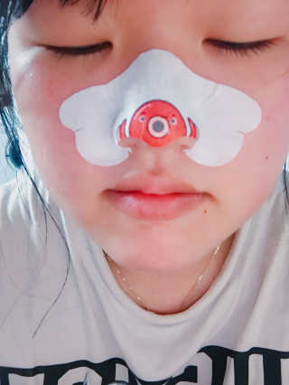 나이팅게일 TAKO PACK NOSE [문어코팩] — 5점을 준 리뷰어가 2017년 4월 올린 사용 사진