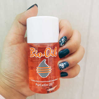 Bio-oil(바이오오일) 바이오오일(Bio-oil) — 4.5점을 준 리뷰어가 2017년 2월 올린 사용 사진