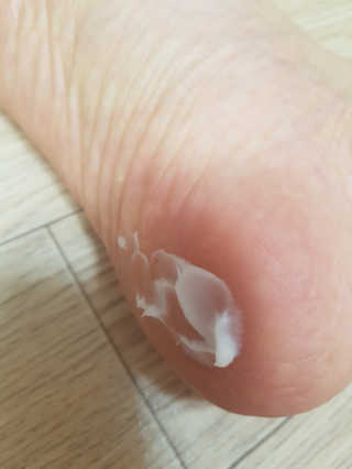 (주)에네스티 에네스티 수안수 실크스킨 풋크림 1+1 — 4점을 준 리뷰어가 2019년 9월 올린 사용 사진
