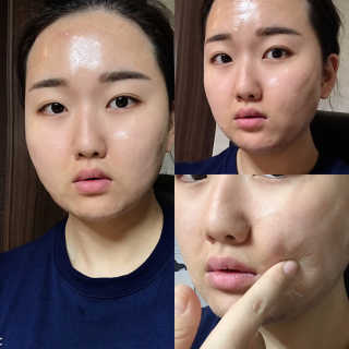 샤인피에이치 쏘큐 리프팅업 페이스 마스크 — 5점을 준 리뷰어가 2019년 1월 올린 사용 사진
