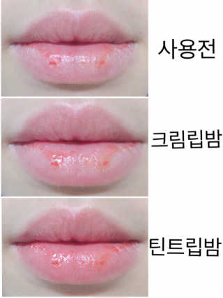 블리스텍스 립 릴리프 크림 립밤, 립 바이브런스 립밤 — 4점을 준 리뷰어가 2018년 11월 올린 사용 사진