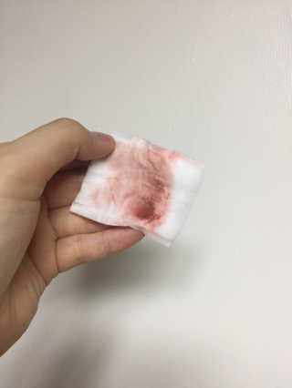 아이소이 센시티브 스킨 안티 더스트 클렌징워터 — 5점을 준 리뷰어가 2018년 7월 올린 사용 사진