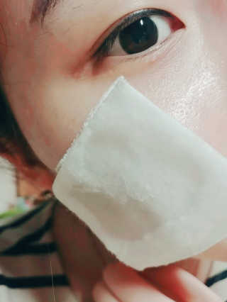 비알티씨 더 퍼스트 앰플 에센스 — 4.5점을 준 리뷰어가 2019년 4월 올린 사용 사진