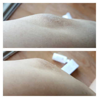 세바메드 클래식 클렌징 바[비누] + 바디로션 15ml — 5점을 준 리뷰어가 2019년 9월 올린 사용 사진