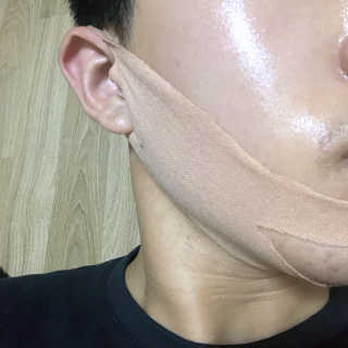아이디플라코스메틱 아이디 페이스핏 마이너스 밴드 — 3점을 준 리뷰어가 2019년 12월 올린 사용 사진