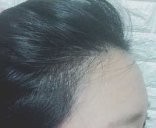RemonStrange님이 올린 리뷰 사진 2